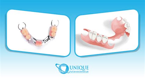 metal denture base fabrication|metal vs plastic partial dentures.